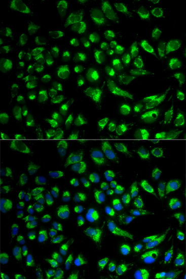 Immunofluorescence - SPAM1 Polyclonal Antibody 