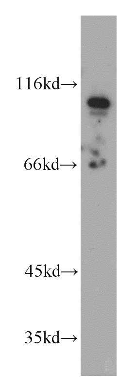 A431 cells were subjected to SDS PAGE followed by western blot with Catalog No:110275(ELF1 antibody) at dilution of 1:100