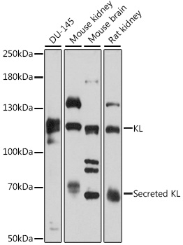 Western blot - KL Polyclonal Antibody 