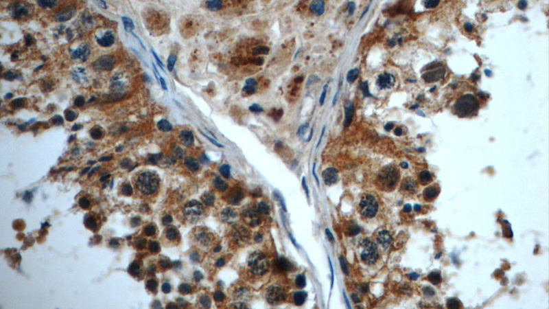 Immunohistochemistry of paraffin-embedded human testis slide using Catalog No:111668(C14orf179 Antibody) at dilution of 1:50 (under 40x lens)