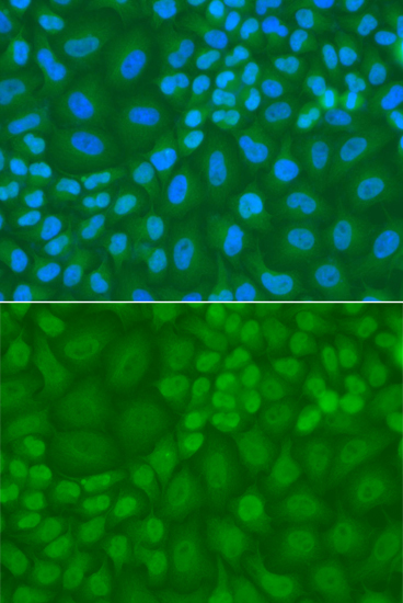 Immunofluorescence - TDG Polyclonal Antibody 