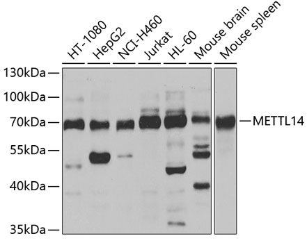 Western blot - METTL14 Polyclonal Antibody 
