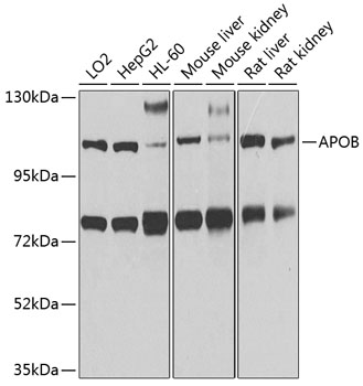 Western blot - APOB Polyclonal Antibody 
