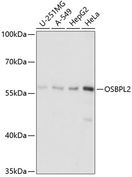 Western blot - OSBPL2 Polyclonal Antibody 