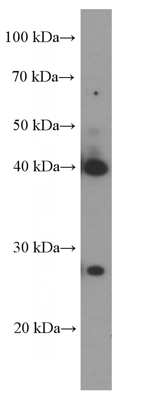 pig liver tissue were subjected to SDS PAGE followed by western blot with Catalog No:107375(LDHA Antibody) at dilution of 1:1500
