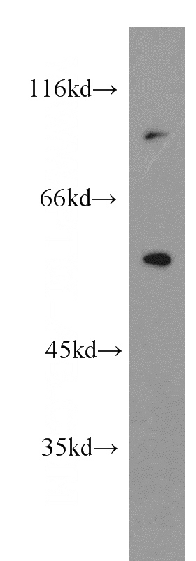 HeLa cells were subjected to SDS PAGE followed by western blot with Catalog No:113198(CDKL3 antibody) at dilution of 1:800