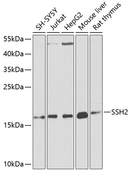 Western blot - SSH2 Polyclonal Antibody 