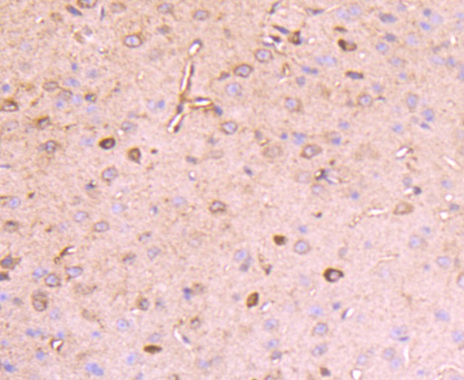 Fig2: Immunohistochemical analysis of paraffin-embedded human brain tissue using anti-Reelin antibody. Counter stained with hematoxylin.