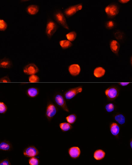 Immunofluorescence - ABCA4 Polyclonal Antibody 