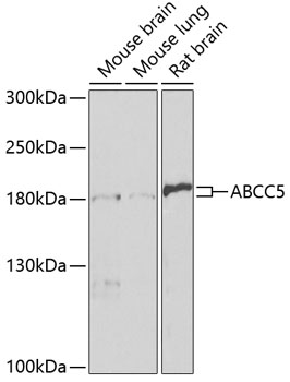 Western blot - ABCC5 Polyclonal Antibody 