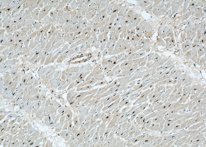 Immunohistochemical of paraffin-embedded human heart using Catalog No:115712(STK17A antibody) at dilution of 1:50 (under 10x lens)