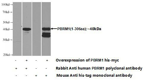 Transfected HEK-293 cells were subjected to SDS PAGE followed by western blot with Catalog No:113613(PBRM1 Antibody) at dilution of 1:1000