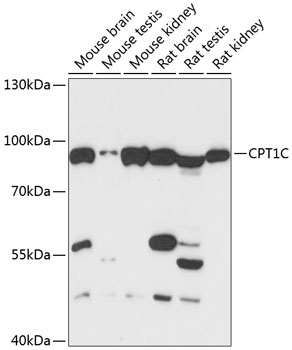Western blot - CPT1C Polyclonal Antibody 