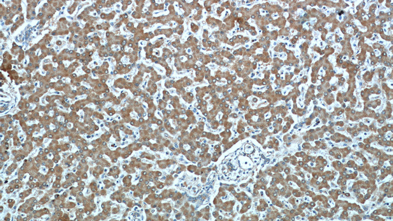 Immunohistochemical of paraffin-embedded human liver using Catalog No:107189(CYB5R3 antibody) at dilution of 1:50 (under 10x lens)
