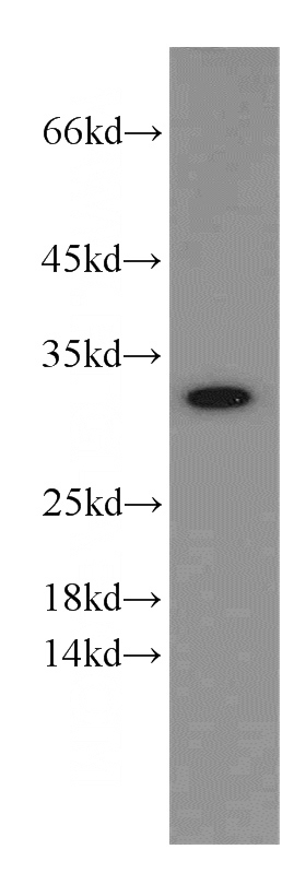 HepG2 cells were subjected to SDS PAGE followed by western blot with Catalog No:116731(VDAC2 antibody) at dilution of 1:600
