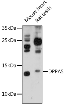 Western blot - DPPA5 Polyclonal Antibody 