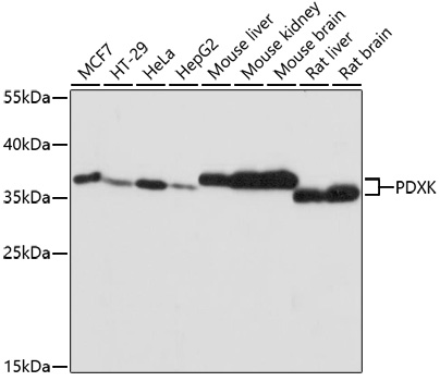 Western blot - PDXK Polyclonal Antibody 