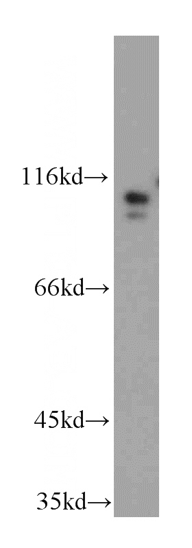 HEK-293 cells were subjected to SDS PAGE followed by western blot with Catalog No:116607(USP33 antibody) at dilution of 1:300