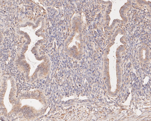 Fig6:; Immunohistochemical analysis of paraffin-embedded human uterus tissue using anti-cGAS antibody. The section was pre-treated using heat mediated antigen retrieval with sodium citrate buffer (pH 6.0) for 20 minutes. The tissues were blocked in 5% BSA for 30 minutes at room temperature, washed with ddH; 2; O and PBS, and then probed with the primary antibody ( 1/200) for 30 minutes at room temperature. The detection was performed using an HRP conjugated compact polymer system. DAB was used as the chromogen. Tissues were counterstained with hematoxylin and mounted with DPX.