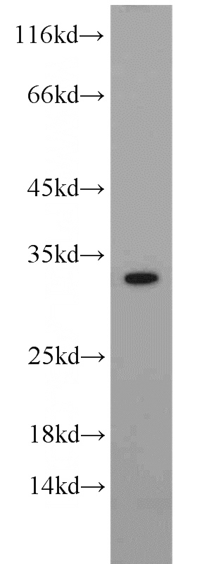 human heart tissue were subjected to SDS PAGE followed by western blot with Catalog No:108844(CAPZA1 antibody) at dilution of 1:200