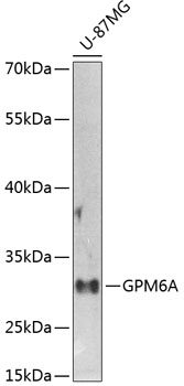 Western blot - GPM6A Polyclonal Antibody 