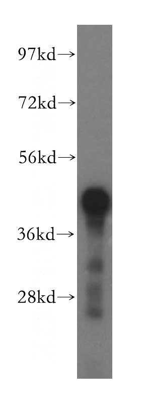 mouse pancreas tissue were subjected to SDS PAGE followed by western blot with Catalog No:110898(GCAT antibody) at dilution of 1:600