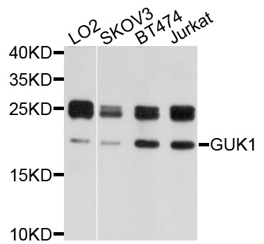 Western blot - GUK1 Polyclonal Antibody 