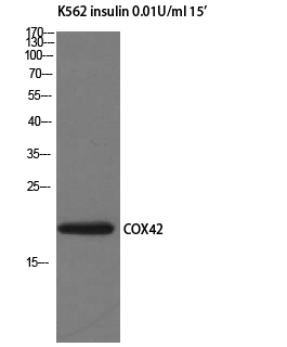 Fig1:; Western Blot analysis of K562 insulin 0.01U/ml 15' cells using COX4I2 Polyclonal Antibody