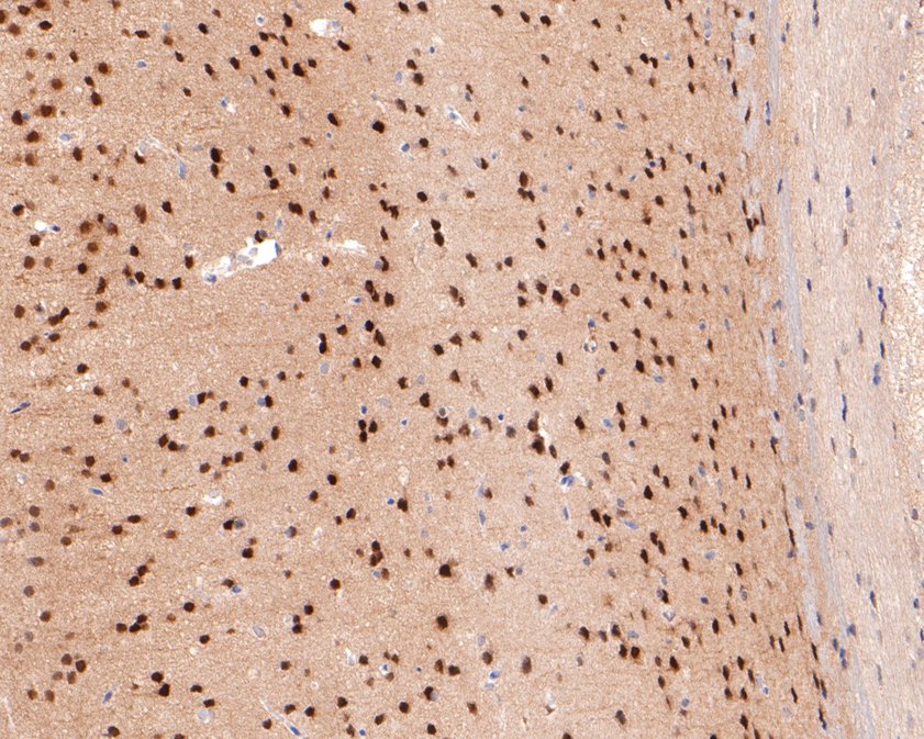 Fig5:; Immunohistochemical analysis of paraffin-embedded mouse brain tissue using anti-USP11 antibody. The section was pre-treated using heat mediated antigen retrieval with sodium citrate buffer (pH 6.0) for 20 minutes. The tissues were blocked in 1% BSA for 30 minutes at room temperature, washed with ddH; 2; O and PBS, and then probed with the primary antibody ( 1/400) for 30 minutes at room temperature. The detection was performed using an HRP conjugated compact polymer system. DAB was used as the chromogen. Tissues were counterstained with hematoxylin and mounted with DPX.