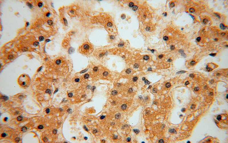 Immunohistochemical of paraffin-embedded human liver using Catalog No:111554(HSDL1 antibody) at dilution of 1:100 (under 40x lens)