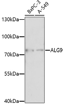 Western blot - ALG9 Polyclonal Antibody 