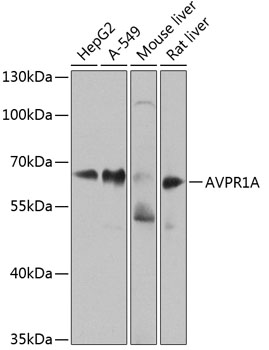Western blot - AVPR1A Polyclonal Antibody 