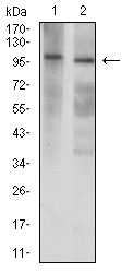 Fig3: Western blot analysis of GRIK3 against A431 (1) and Hela (2) cell lysate. Proteins were transferred to a PVDF membrane and blocked with 5% BSA in PBS for 1 hour at room temperature. The primary antibody ( 1/500) was used in 5% BSA at room temperature for 2 hours. Goat Anti-Mouse IgG - HRP Secondary Antibody at 1:5,000 dilution was used for 1 hour at room temperature.