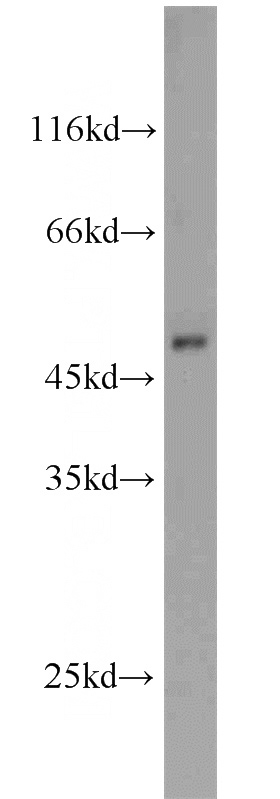 mouse liver tissue were subjected to SDS PAGE followed by western blot with Catalog No:115000(SCLY antibody) at dilution of 1:500