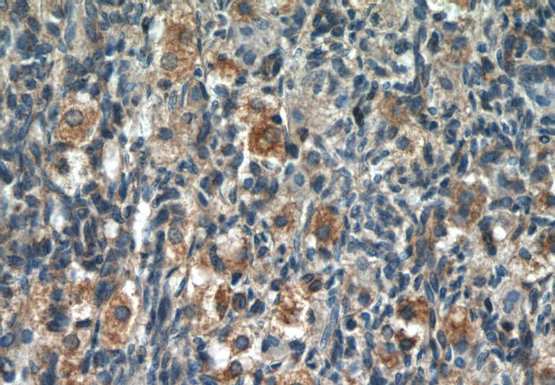 Immunohistochemistry of paraffin-embedded human ovary tissue slide using Catalog No:114066(POTEA Antibody) at dilution of 1:50 (under 40x lens)