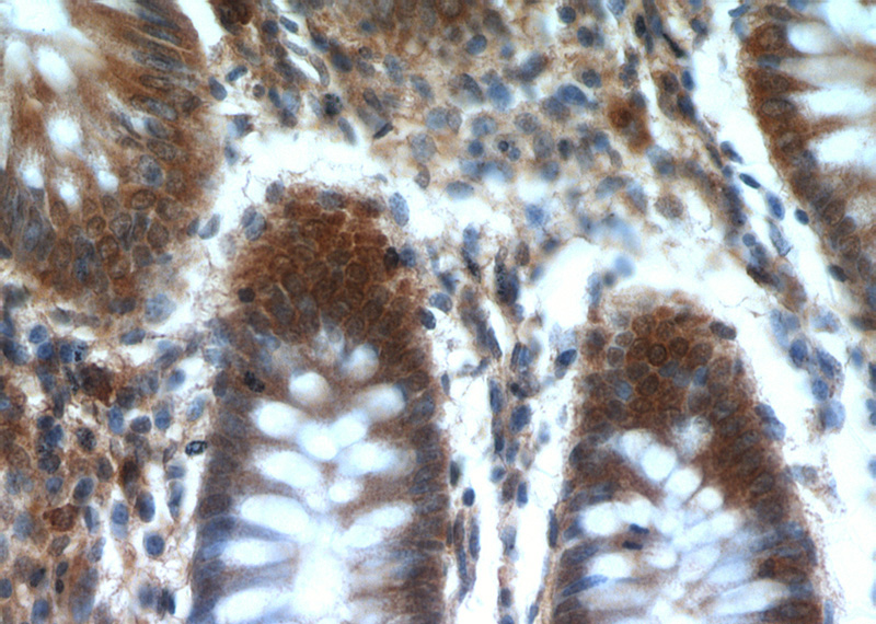 Immunohistochemical of paraffin-embedded human colon using Catalog No:110469(FAM127B antibody) at dilution of 1:100 (under 40x lens)