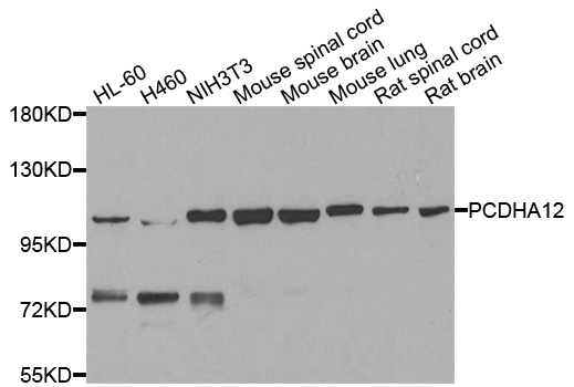 Western blot - PCDHA12 Polyclonal Antibody 