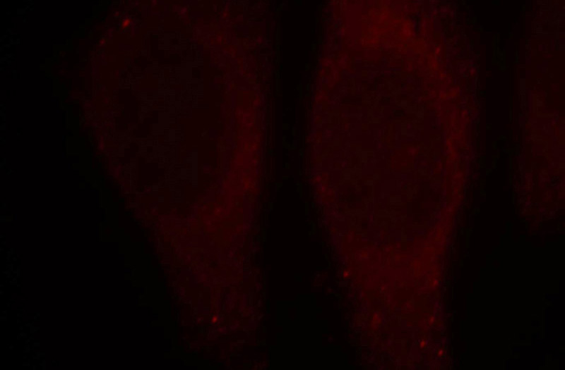 Immunofluorescent analysis of HepG2 cells, using PNPLA6 antibody Catalog No:113982 at 1:25 dilution and Rhodamine-labeled goat anti-rabbit IgG (red).