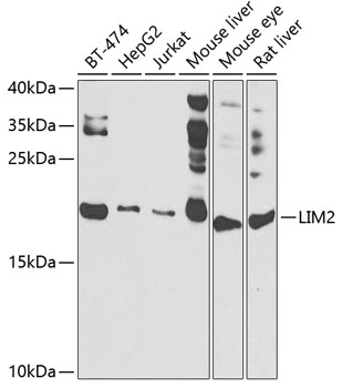 Western blot - LIM2 Polyclonal Antibody 