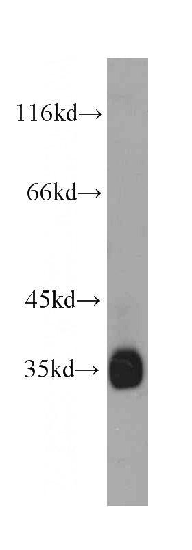 HepG2 cells were subjected to SDS PAGE followed by western blot with Catalog No:107222(FST antibody) at dilution of 1:1000