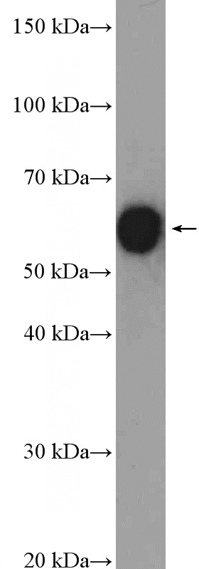 mouse kidney tissue were subjected to SDS PAGE followed by western blot with Catalog No:109037(CCT8 Antibody) at dilution of 1:1500