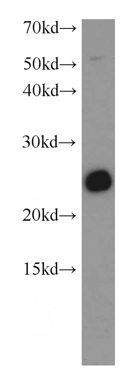 mouse brain tissue were subjected to SDS PAGE followed by western blot with Catalog No:115446(SNAP antibody) at dilution of 1:500