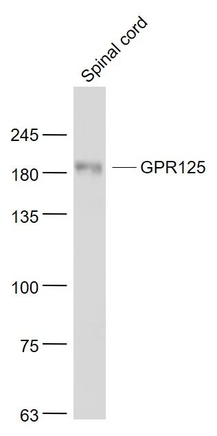 Fig3: Sample:; Spinal cord (Mouse) Lysate at 40 ug; Primary: Anti- GPR125 at 1/1000 dilution; Secondary: IRDye800CW Goat Anti-Rabbit IgG at 1/20000 dilution; Predicted band size: 143 kD; Observed band size: 183 kD