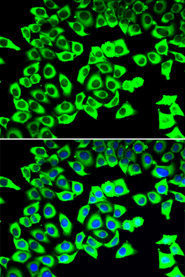 Immunofluorescence - RPLP2 Polyclonal Antibody 