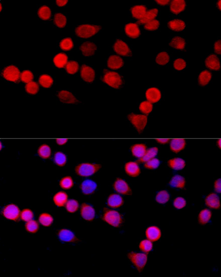 Immunofluorescence - CYBA Polyclonal Antibody 