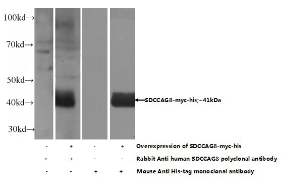 Transfected HEK-293 cells were subjected to SDS PAGE followed by western blot with Catalog No:115028(SDCCAG8 Antibody) at dilution of 1:500