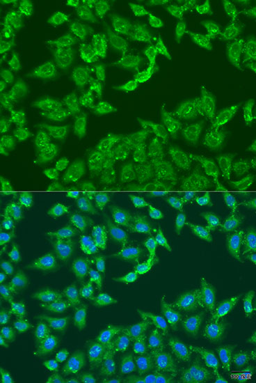 Immunofluorescence - ADAP1 Polyclonal Antibody 