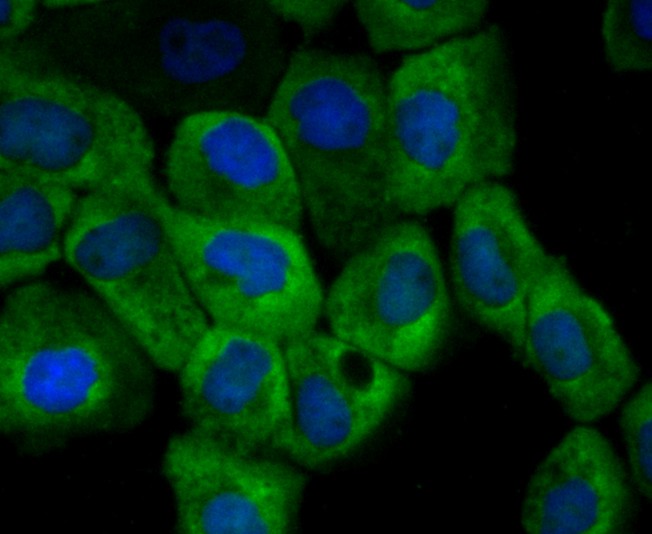 Fig2: ICC staining CD137 (green) in A431 cells. The nuclear counter stain is DAPI (blue). Cells were fixed in paraformaldehyde, permeabilised with 0.25% Triton X100/PBS.