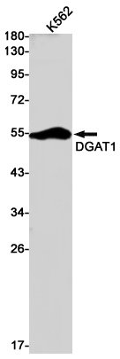 Western blot detection of DGAT1 in K562 cell lysates using DGAT1 Rabbit pAb(1:1000 diluted).Predicted band size:55kDa.Observed band size:55kDa.