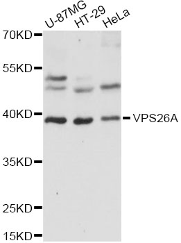 Western blot - VPS26A Polyclonal Antibody 